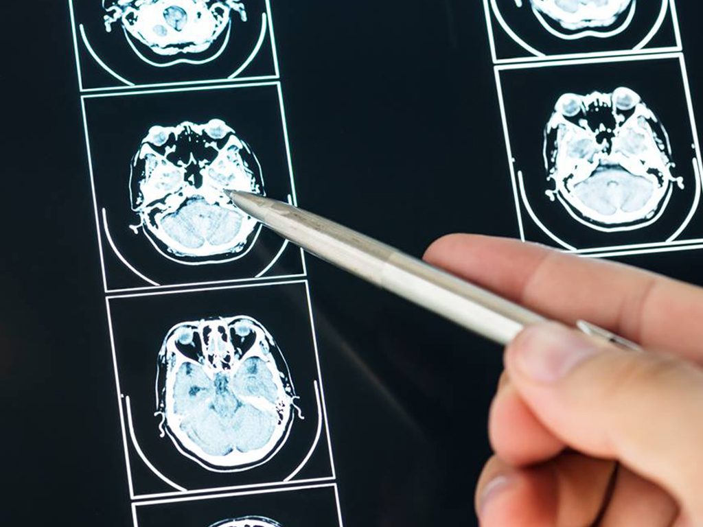 Neurologia Neurolog Avimed