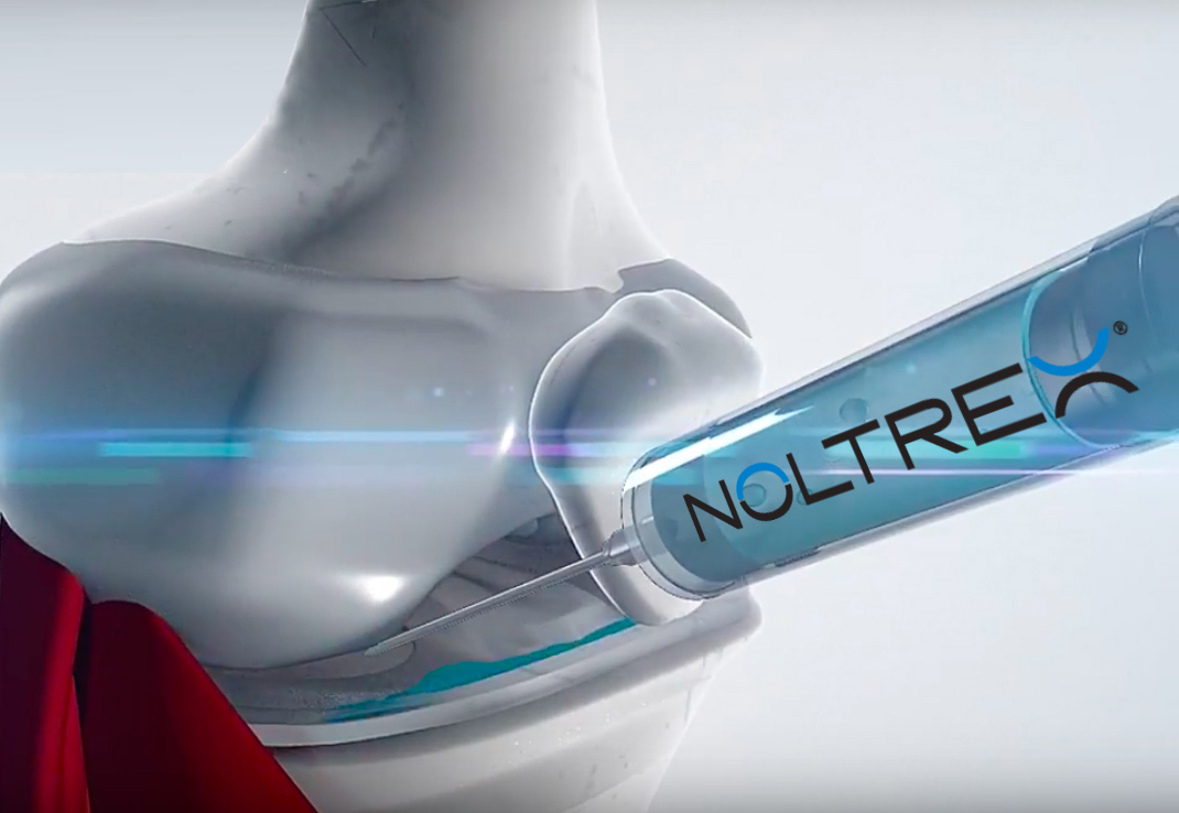 NOLTREX™ – płynna endoproteza