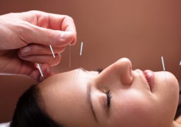Akupunktura czaszki