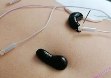Hirudoterapia: Na co pomaga leczenie pijawkami?